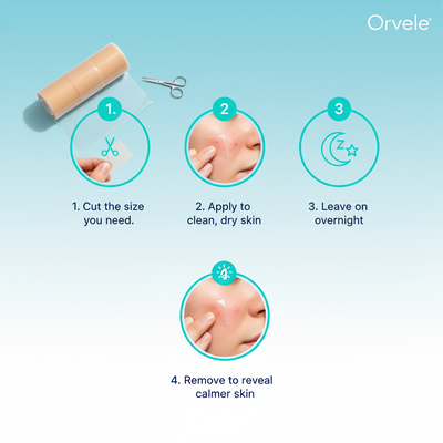 Orvele™ Hydrocolloid Roll