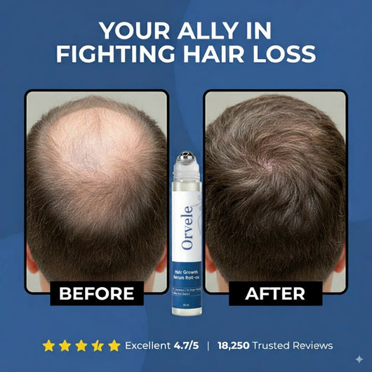 Advanced Hair Growth Roll-On Serum