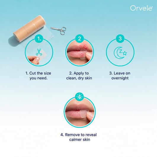 How to apply the hydrocolloid patch on a cold sore
